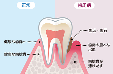 定期検診で早期発見が第一